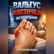 Постер книги Вальгус Косточка на попечении