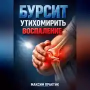 Постер книги Бурсит Утихомирить воспаление