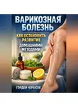 Гордей Черкасов - Варикозная болезнь как остановить развитие домашними методами