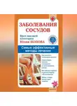 Юлия Попова - Заболевания сосудов. Самые эффективные методы лечения