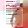 Алексей Садов - Грыжа позвоночника. Безоперационное лечение и профилактика