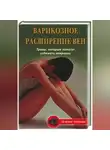 Ольга Абрамович - Варикозное расширение вен. Травы, которые помогут избежать операции