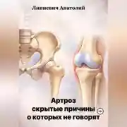 Постер книги Артроз: скрытые причины, о которых не говорят