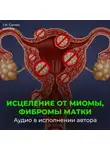 Георгий Сытин - Исцеление от миомы, фибромы матки