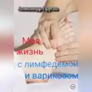 Постер книги Моя жизнь с лимфедемой и варикозом