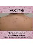 Jones Owen - Acne Treatment