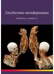 Дмитрий Романов - Сосудистые мальформации
