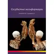 Постер книги Сосудистые мальформации