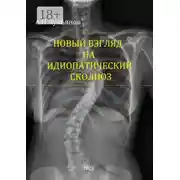 Постер книги Новый взгляд на идиопатический сколиоз
