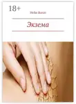 Heike Bonin - Экзема