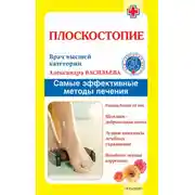 Постер книги Плоскостопие. Самые эффективные методы лечения