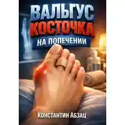 Постер книги Вальгус. Косточка на попечении