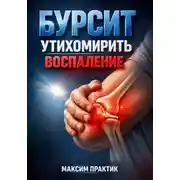 Постер книги Бурсит. Утихомирить воспаление