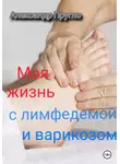 Александр Пругло - Моя жизнь с лимфедемой и варикозом