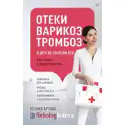 Постер книги Отеки, варикоз, тромбоз и другие болезни вен. Как лечить и предотвратить