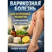 Постер книги Варикозная болезнь как остановить развитие домашними методами