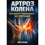 Постер книги Артроз колена как вернуть подвижность без операции