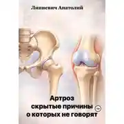 Постер книги Артроз: скрытые причины, о которых не говорят