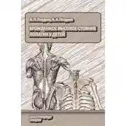 Постер книги Врожденное высокое стояние лопатки у детей