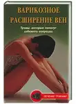 Ольга Абрамович - Варикозное расширение вен. Травы, которые помогут избежать операции